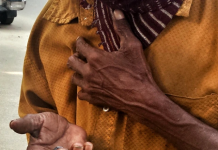 CAAWI MASAAKIINTA IYO DANYARTA OO HA U DEYMO LA’AAN