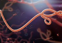 Ivory Coast oo diiwaangelisay kiiskii ugu horreeyay ee cudurka Ebola